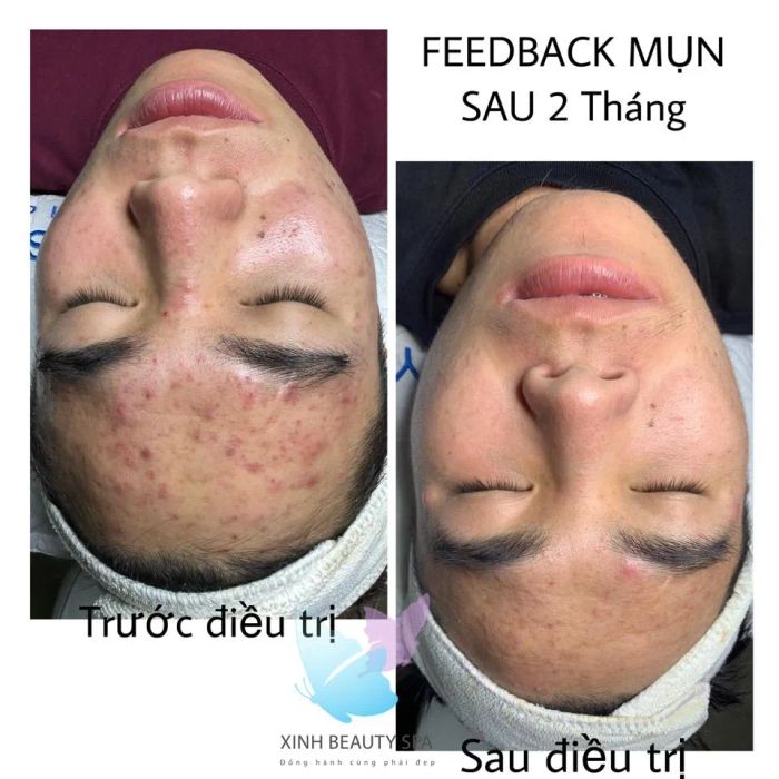 Không gian sang trọng và hiện đại tại Xinh Beauty Spa & Clinic Q12