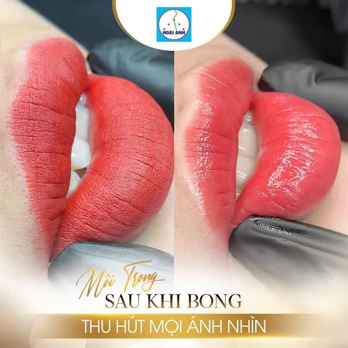 Không gian trị liệu sang trọng tại Thẩm Mỹ Viện Hoài Anh