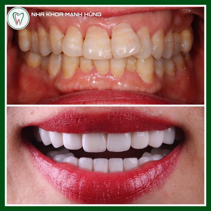 Hình ảnh cơ sở vật chất hiện đại đạt chuẩn Châu Âu tại Nha Khoa Mạnh Hùng