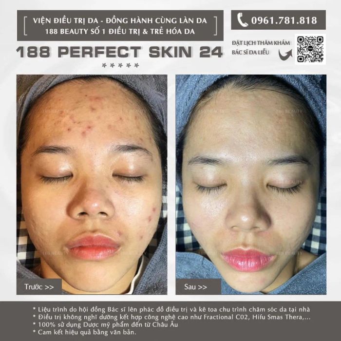 Hình ảnh quy trình trị liệu chuyên nghiệp tại Spa Shynh Beauty