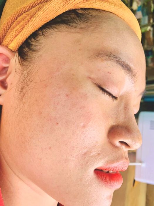 Hình ảnh trị liệu chuyên sâu tại Lâm Kiều Spa