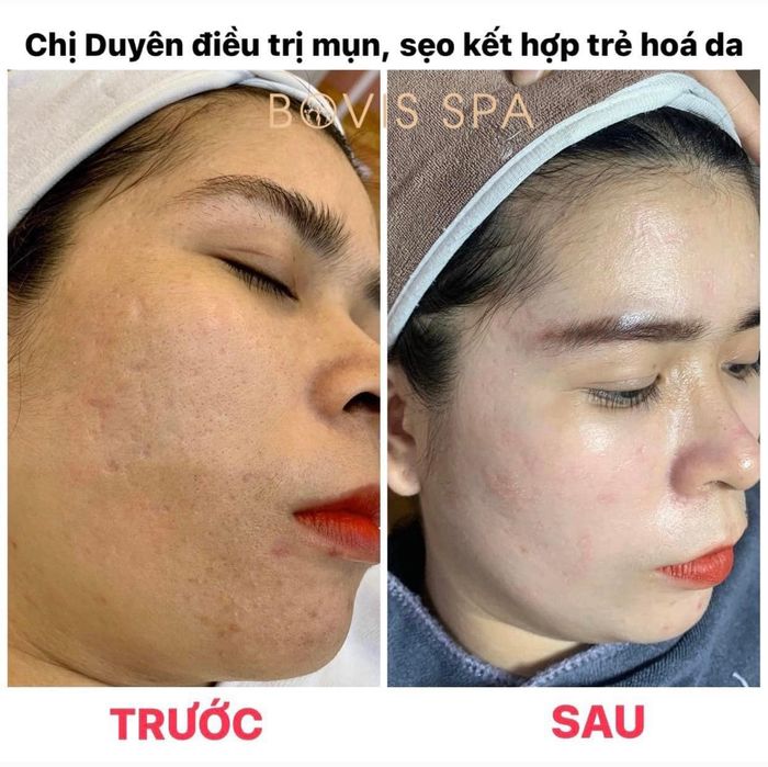 Bovis Spa and Academy hình ảnh 2