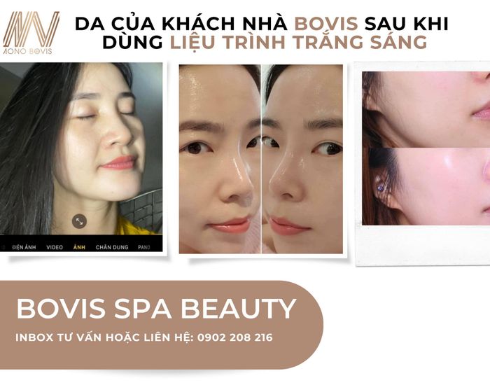 Bovis Spa and Academy hình ảnh 1