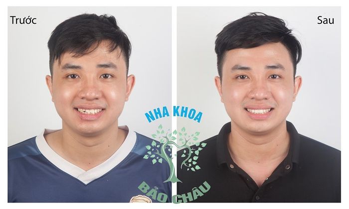 Hình ảnh thực tế về không gian hiện đại tại Nha Khoa Bảo Châu