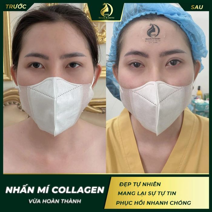 Hình ảnh thực tế Viện Thẩm Mỹ Nari