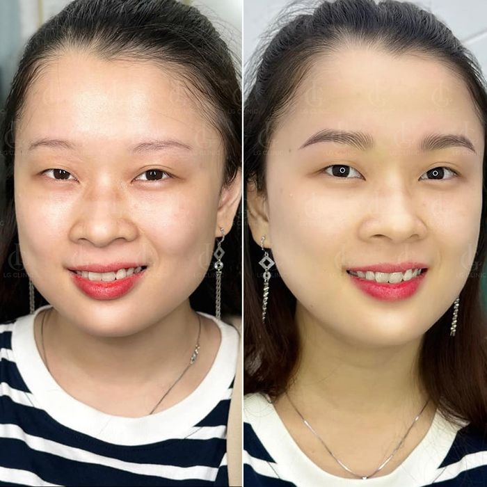 Little Garden Beauty & Spa ảnh 3