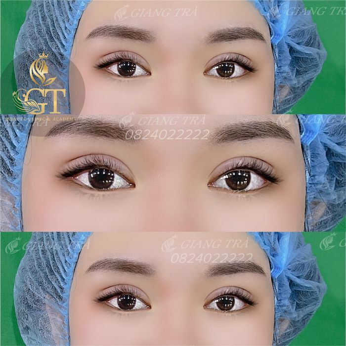 Hình ảnh Giang Trà Beauty Clinic (ảnh 1)