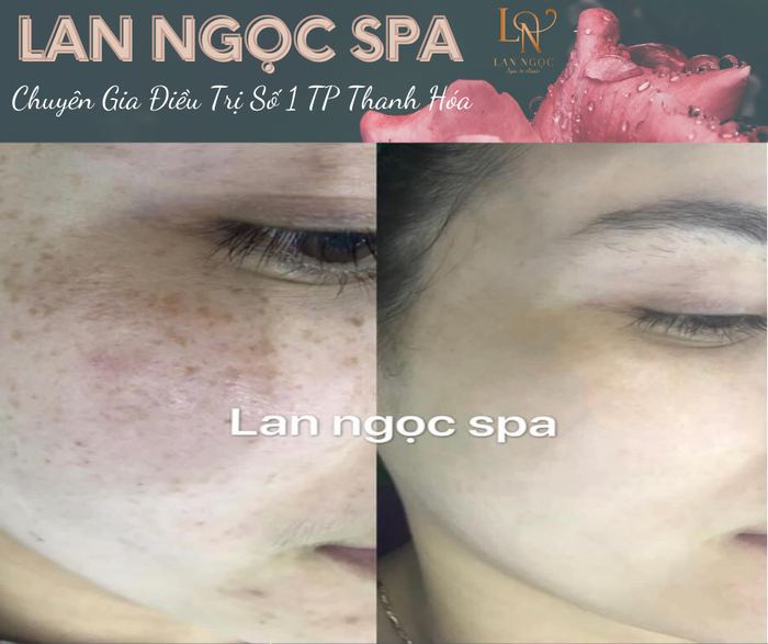 Lan Ngọc Spa hình ảnh 1