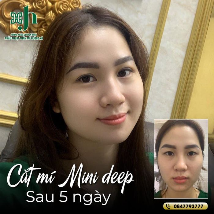 Thẩm Mỹ Viện Hường Xô - Hình ảnh thực tế ấn tượng