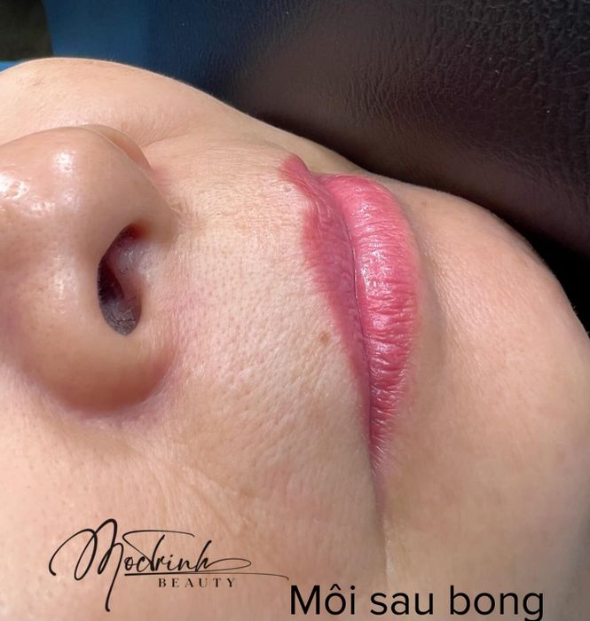 Hình ảnh thứ hai tại Mộc Trinh Beauty