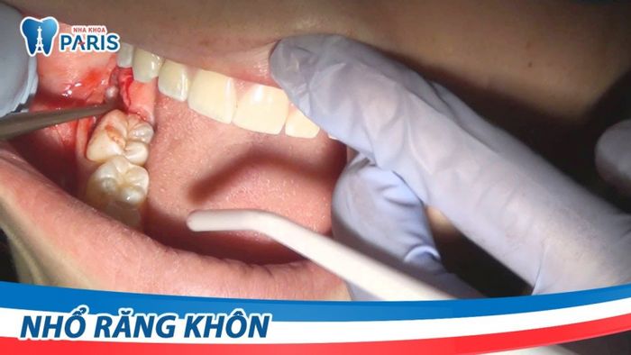Hình ảnh Nha khoa Paris - Không gian sang trọng đạt chuẩn Pháp