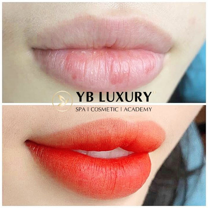 Viện Thẩm Mỹ Quốc Tế YB Spa ảnh 2