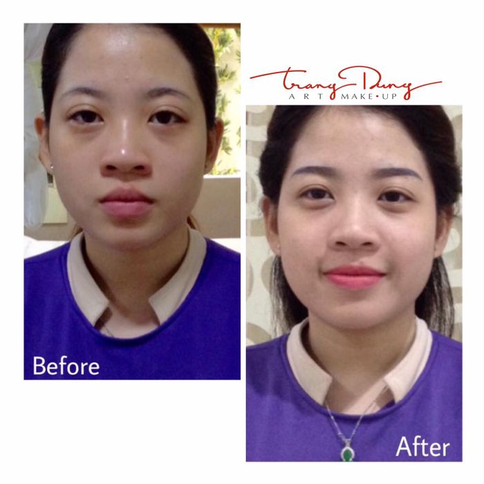 Thẩm mỹ viện Trang Dung ảnh 3