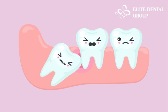 Hình ảnh đội ngũ bác sĩ Elite Dental - Chuyên gia răng hàm mặt