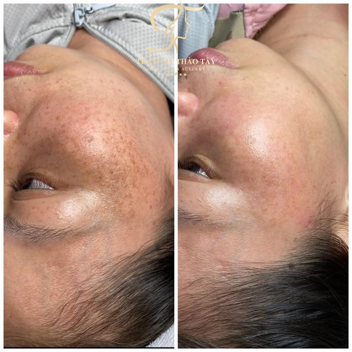 Thẩm Mỹ Quốc Tế Thảo Tây hình ảnh 1