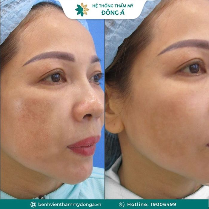 Thẩm Mỹ Viện Đông Á - Chi Nhánh Thanh Hóa hình ảnh 1