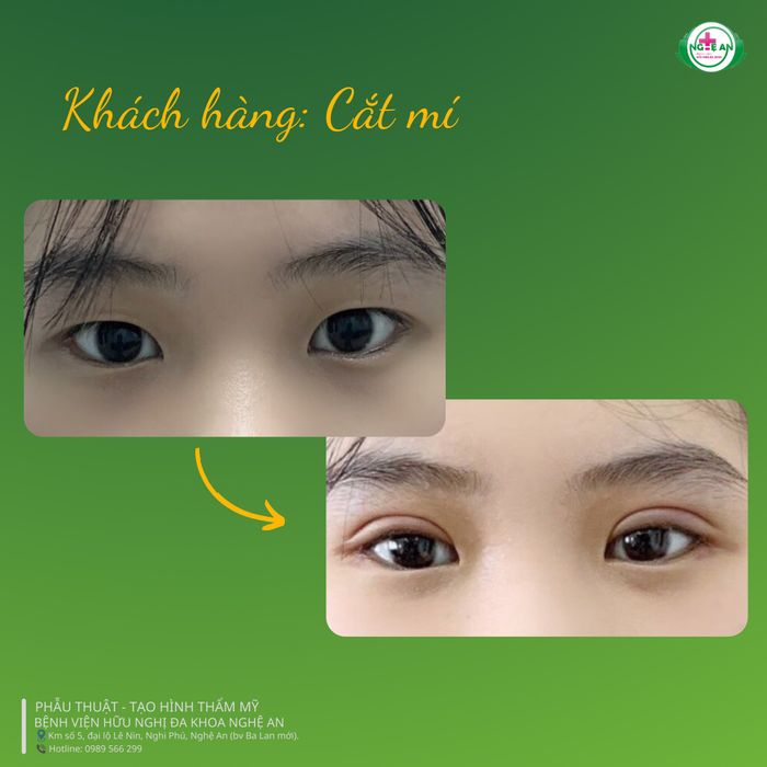 Hình ảnh Trung tâm Thẩm mỹ - Bệnh viện Hữu nghị Đa khoa Nghệ An (ảnh 2)