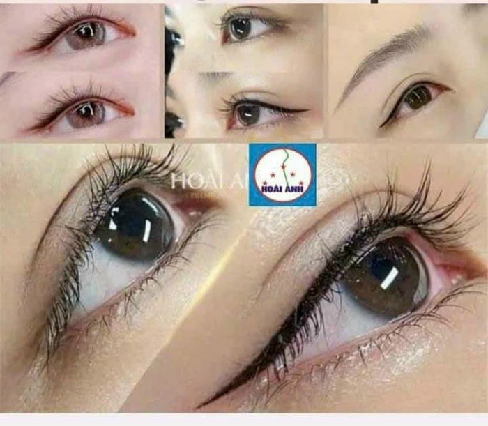 Thẩm mỹ viện Hoài Anh ảnh 2
