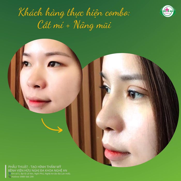 Hình ảnh Trung tâm Thẩm mỹ - Bệnh viện Hữu nghị Đa khoa Nghệ An