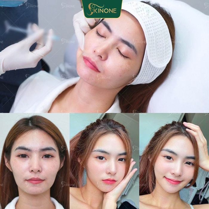 Ảnh Phòng Khám Da Liễu Chuyên Sâu SkinOne - 2