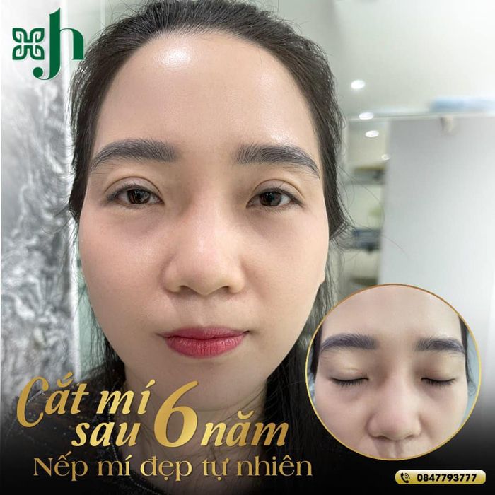 Thẩm Mỹ Viện Hường Xô - Bộ sưu tập hình ảnh đẳng cấp