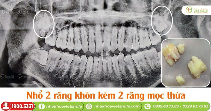 Hình ảnh Nha khoa Việt Smile - Cơ sở vật chất hiện đại