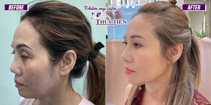 Thẩm Mỹ Viện Thủy Tiên ảnh 1