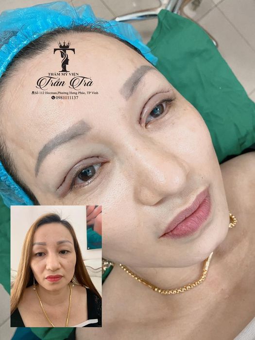 Thẩm Mỹ Viện Trần Trà - Hình ảnh ấn tượng