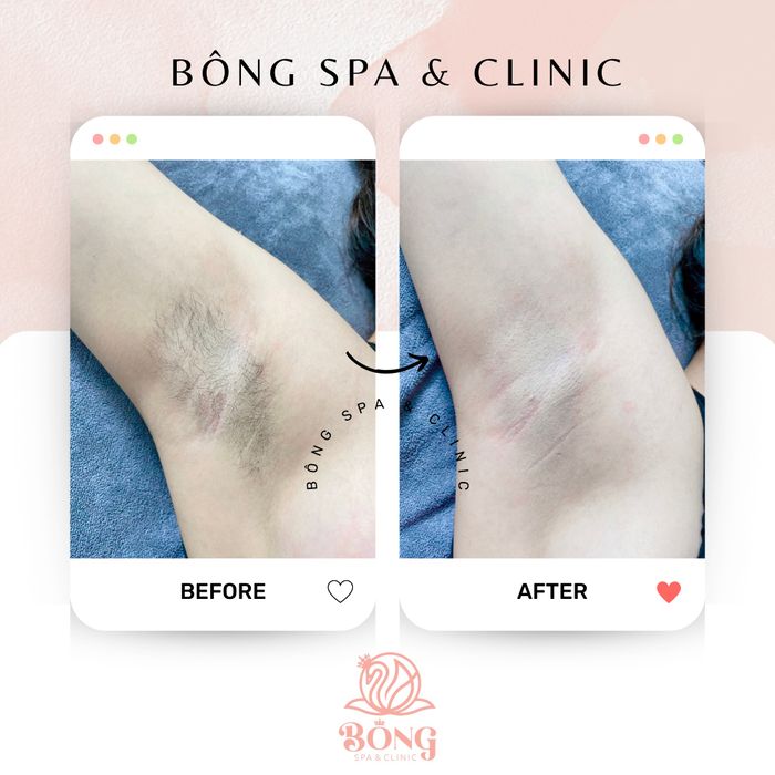 Bông Spa - Healthy & Beauty, hình ảnh cơ sở đẹp mắt, chuyên nghiệp