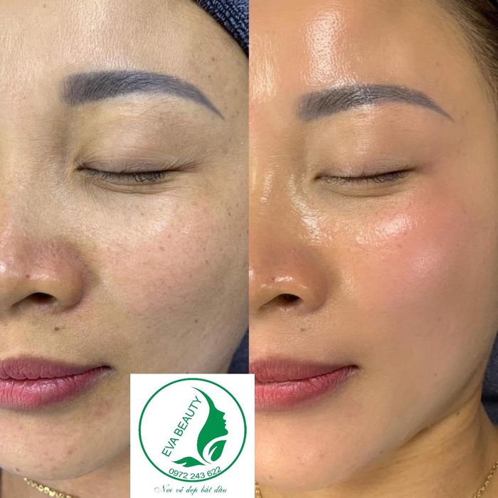 Eva Beauty Spa hình ảnh 1