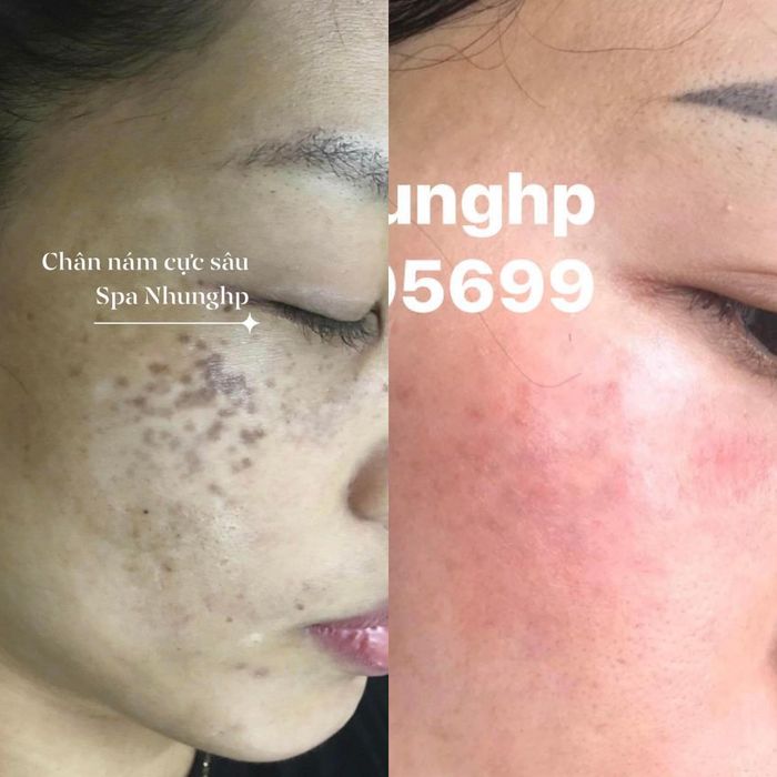 Spa Nhung HP hình ảnh 2