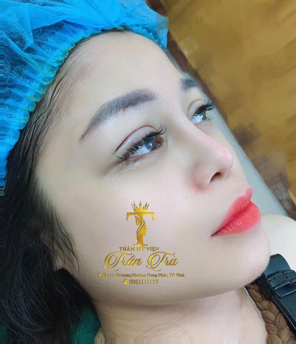 Hình ảnh Thẩm Mỹ Viện Trần Trà (ảnh 1)