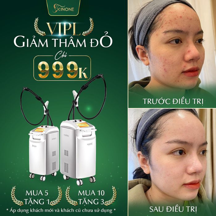 Ảnh Phòng Khám Da Liễu SkinOne