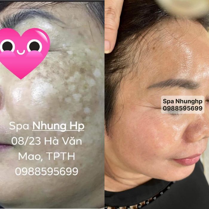 Spa Nhung HP hình ảnh 1