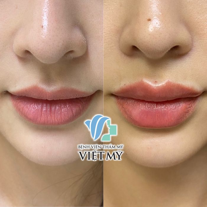 Bệnh Viện Thẩm Mỹ Việt Mỹ ảnh 2