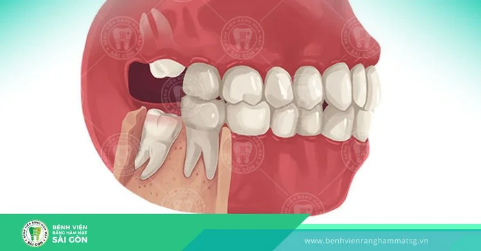 Hình ảnh phòng điều trị Bệnh viện Răng Hàm Mặt Sài Gòn - Tiêu chuẩn quốc tế