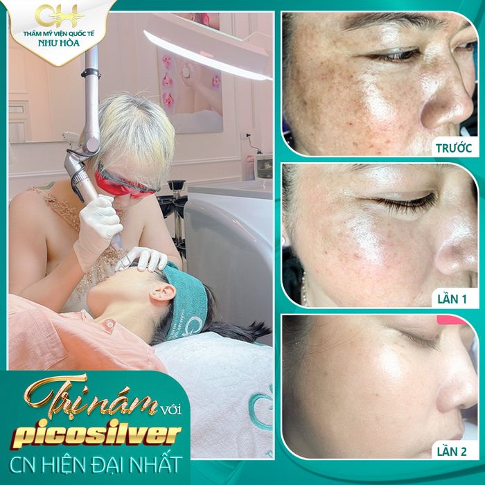 Thẩm Mỹ Viện Quốc Tế Như Hoa ảnh 1