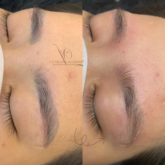 Vy Trương - Phun Xăm Thẩm Mỹ Chuyên Nghiệp ảnh 2