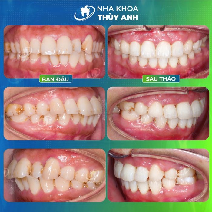 Nha Khoa Thùy Anh - Hình ảnh nổi bật 2