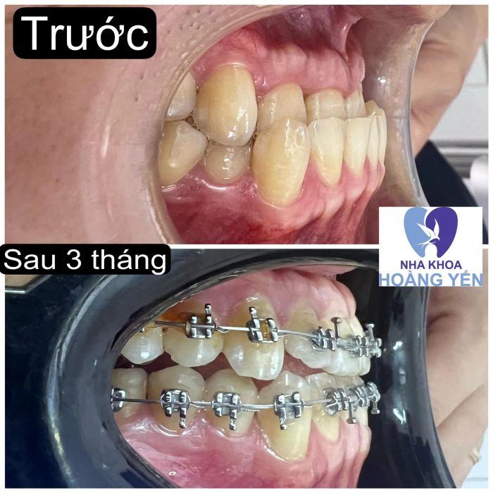 Phòng khám Nha Khoa Hoàng Yến - Hình ảnh nổi bật 1