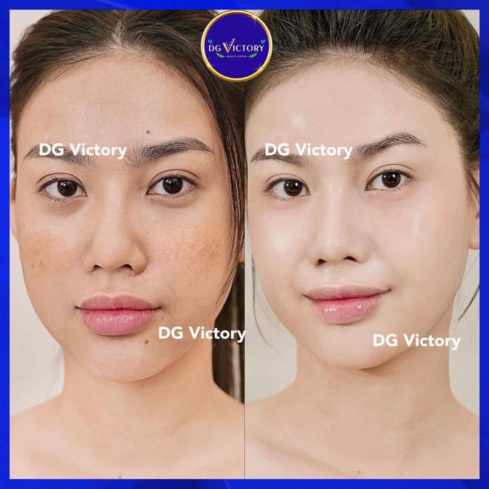 Khám phá không gian sang trọng và dịch vụ đẳng cấp tại Viện Thẩm Mỹ DG Victory qua góc nhìn ấn tượng