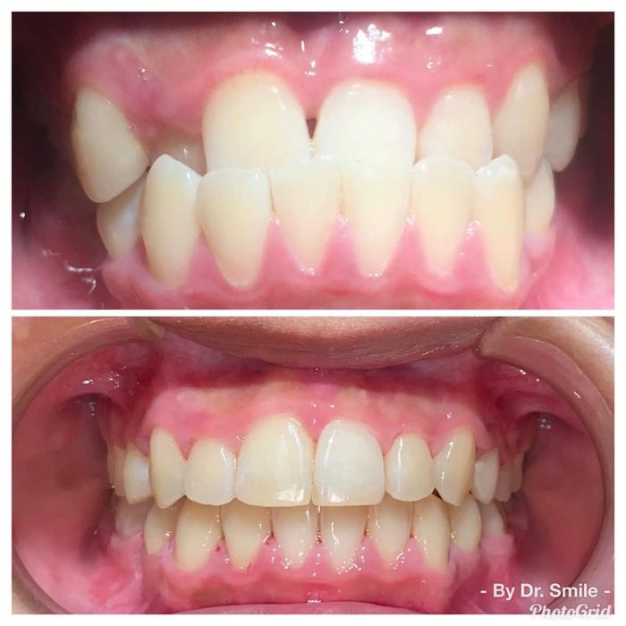Hình ảnh ấn tượng về Nha Khoa Dr. Smile Đà Lạt - Nơi trao gửi nụ cười tỏa sáng