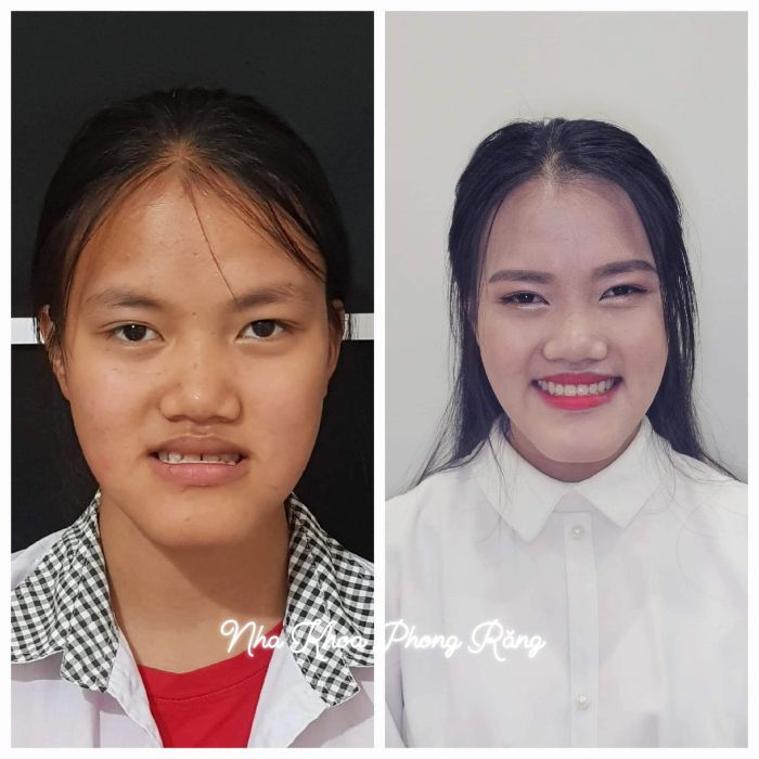 NHA KHOA PHONG RĂNG - Hình ảnh nổi bật 2