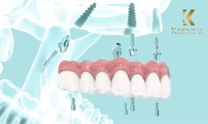 Hệ thống phòng điều trị tiêu chuẩn tại KDental