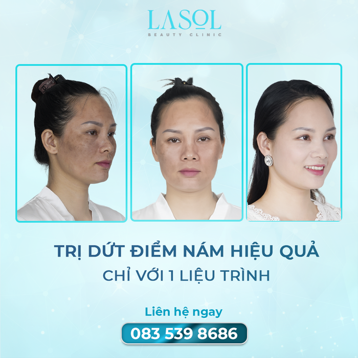 Trải nghiệm không gian sang trọng và dịch vụ đẳng cấp tại LaSol Beauty