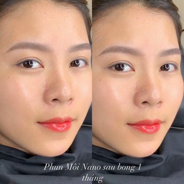 BST hình ảnh ấn tượng từ Thẩm mỹ Tấm Xinh - Ảnh 2