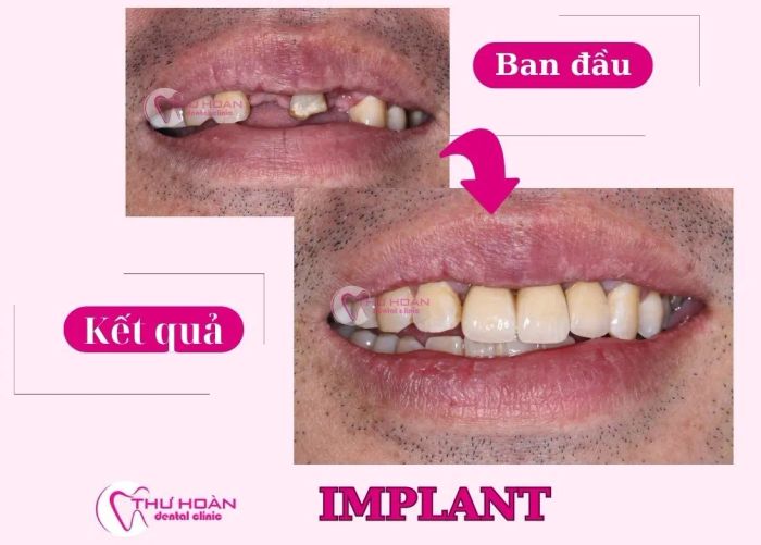 Không gian hiện đại tại Nha Khoa Thư Hoàn