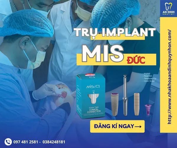 Hình ảnh thực tế về dịch vụ trồng răng Implant tại Nha khoa An Định