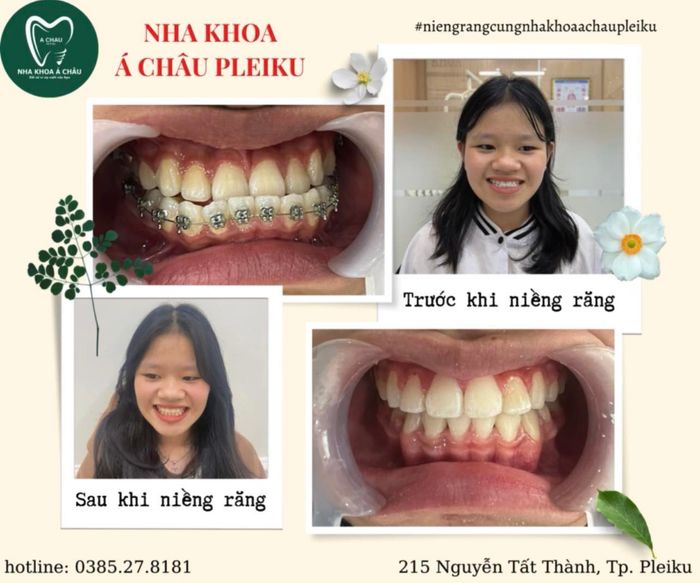 Hình ảnh đội ngũ bác sĩ chuyên nghiệp tại Nha Khoa Á Châu