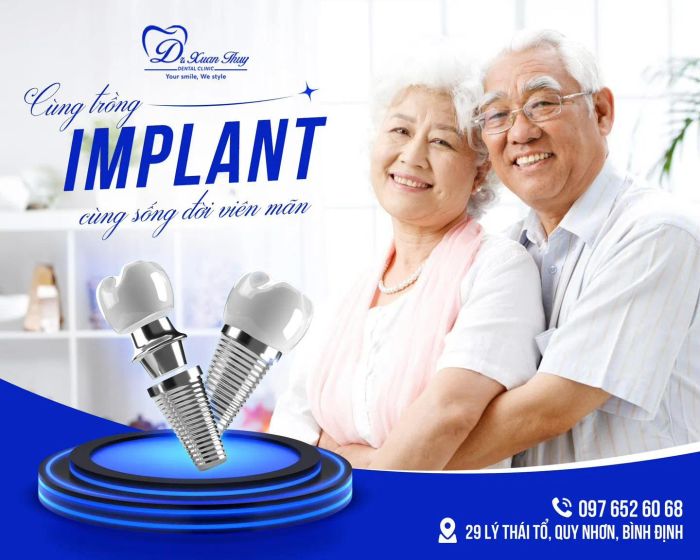 Hình ảnh minh họa quy trình Implant chuẩn quốc tế tại Nha khoa Xuân Thuỷ
